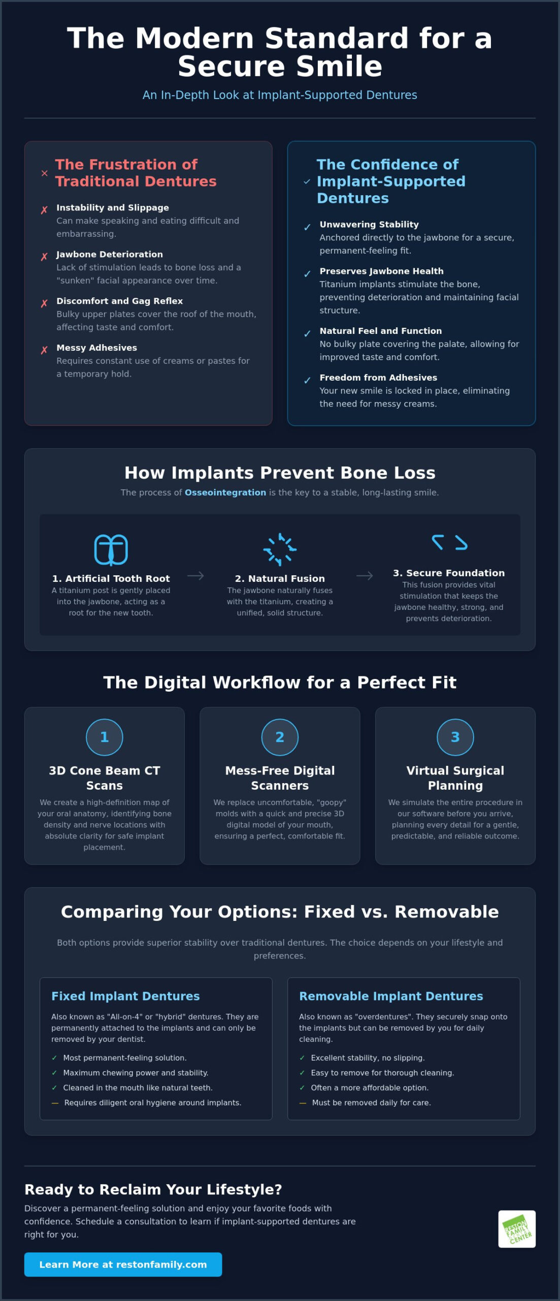 Secure Your Smile: The Complete Guide to Implant-Supported Dentures in Reston