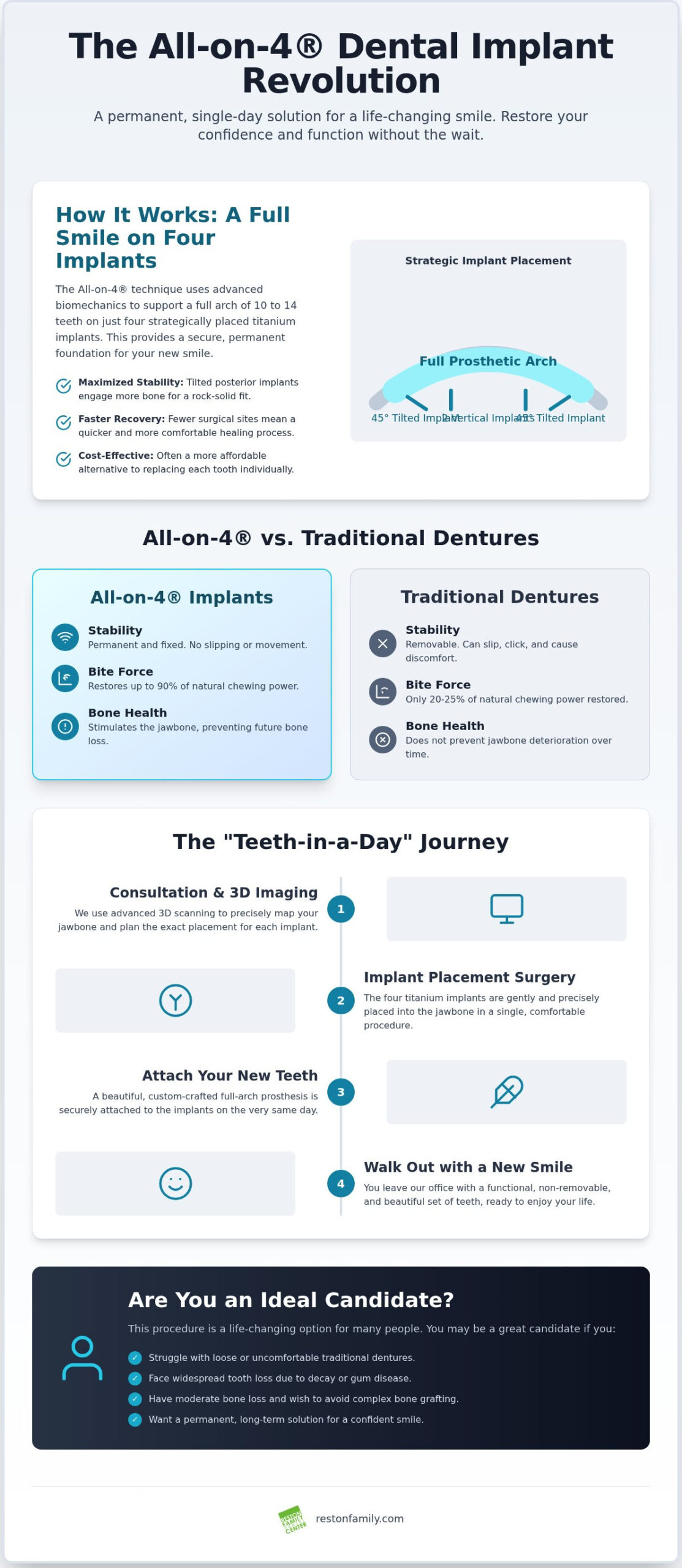 What Are All-on-4 Dental Implants? A Modern Solution for Reston Patients